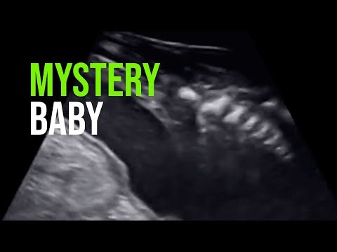 Cheyenne Mountain Zoo Announces Giraffe Pregnancy