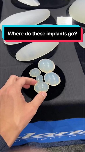 Where Do Silicone Implants Go? Explained by a Plastic Surgeon