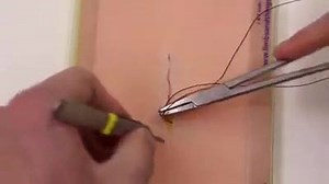 Running Subcuticular Sttitch ... | General Nursing Students