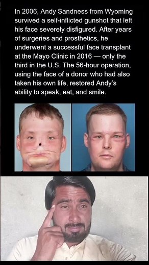 The Man Who Got His Smile Back