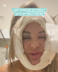 24K views · 144 reactions | We both went to Turkey to get the same plastic surgery done - we want to look 20 years younger 爛 | Ultimate | Facebook