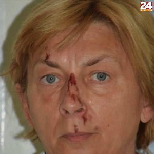 69K views · 150 reactions | Do you know this woman? She doesn't know her name or where she's from. She was found on the island of Krk in Croatia. Help us find her friends or relatives. | 24sata | Facebook