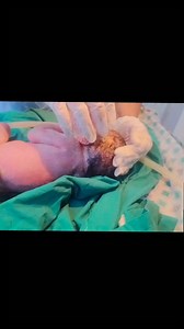 female baby came withno breath but now cry and cleaning done baby is so small and cute🖤❣️ #virelshirts #baby #post #viral #trending | Anoop Gautam