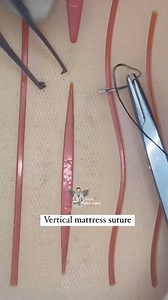 Stitching ✅ #stitch #knowledge #practice #doctor #bums #medicalstudent #nursing #mbbs #hospital | Dr.mhmedical