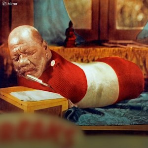 He was called the “Human Caterpillar”. He had no arms or legs. And the fact that he survived was a mystery. Prince Randian just wanted to live in peace. But his appearance doomed him to a life as a freak. | Vitamin