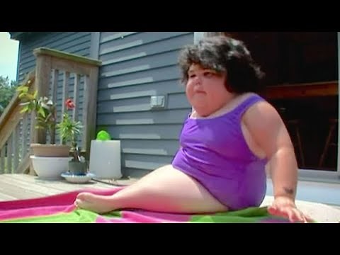 “Mermaid Girl” Shiloh Pepin was born with mystery disease – defied doctors’ odds for 10 years