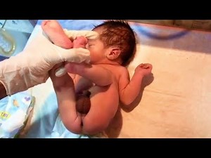 Baby’s First Diaper Change & First Poop 💩 Removal | Step-by-Step Guide