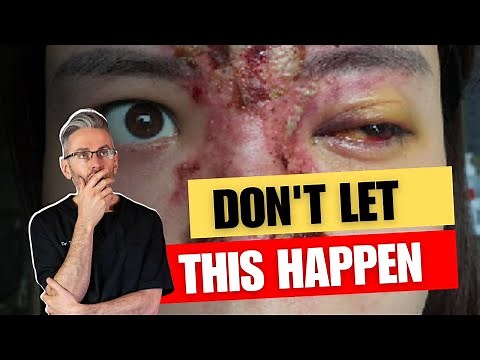 5 Early Warning Signs of a Vascular Occlusion