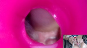 Andrada peehole endoscope view - 10/4