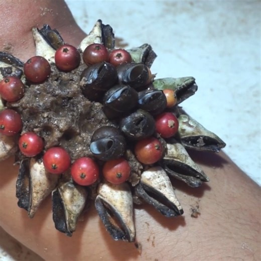 Wow!! scratching dandruff satisfying worms Removal #ticks #removetick #Dandruff #dandrufftreatment #dandruffremoval | Giant 2.0