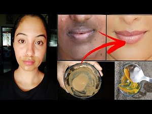 How to remove pigmentation, darkness around mouth with natural remedies.