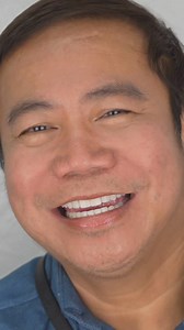 Full mouth rehabilitation using zirconia crowns & veneers 🧡💚 #DrRFD #DrRFDSmile #urbansmilesdentalclinic #WhereBeautifulSmilesAreMade #smilemakeover #smiletransformation | Dr.RFD