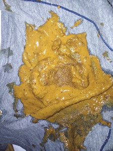 Crazy diarrhea compilation