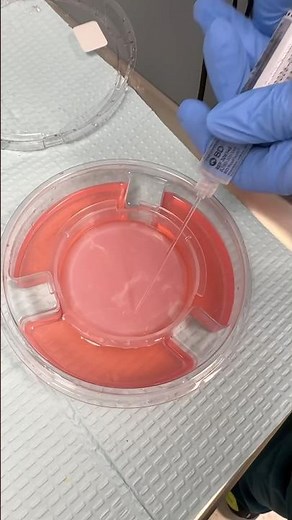 Foreskin Graft! 😳