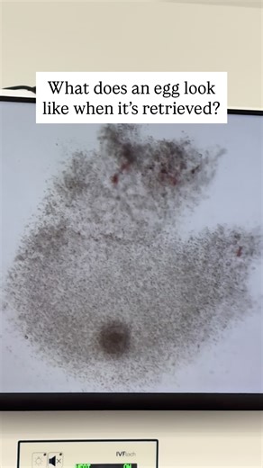 5.2K views · 66 reactions | Behind the Scenes in the IVF Lab:...