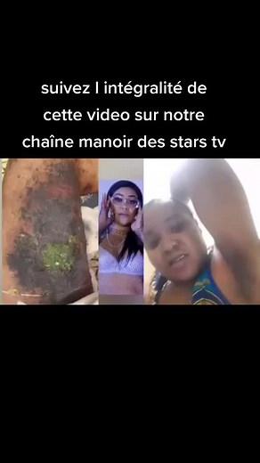 Understanding Severe Skin Conditions: Causes and Treatments