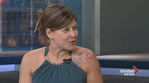 Textured breast implants may put your health at risk