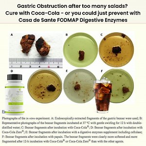 Gastric Bezoars - hard accumulations of non-digestible vegetable or other materials - can develop in people with poor gastric emptying due to hypothyroidism, diabetes or gastric surgery, etc. Coke has been shown to be even more effective than digestive enzymes at breaking down these nasty and dangerous bezoars. Some ingredients in Coke like acids & CO2 play a key role in bezoar dissolution. Prevent bezoars with Casa de Sante low FODMAP digestive enzymes available at casadesante.com. | Casa de sa