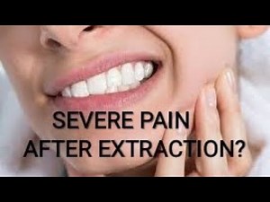 DRY SOCKET- REASON AND MANAGEMENT