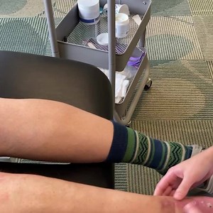 Scar mobilization helps with proper scar mobility to aid with gains to restore normal joint ROM and can improve over all scar appearance. #scarmobilization #scarhealing #scartherapy #physicaltherapy #jointrangeofmotion #scar #scars | BioMechanic Physical Therapy | Facebook