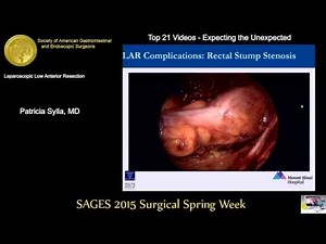 Laparoscopic Low Anterior Resection from the SAGES Video Library