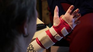 How do you get a hand transplant in the UK?