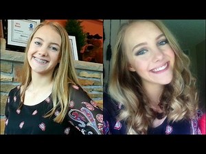 Getting My Braces Off Vlog