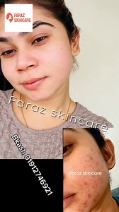 23K views · 105 reactions | Whitening night cream and magic whitening face pack review 01922094083 inbox for Oder  Part 10 | FARAZ SKIN CARE | Facebook