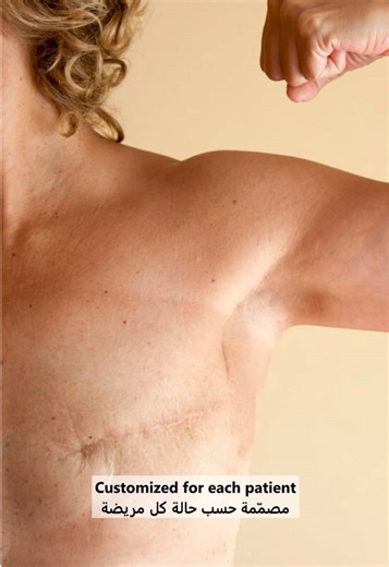A handmade nipple prosthesis that looks and feels incredibly real. Every shade, every detail, designed to restore confidence and natural feminine appearance. حلمة اصطناعية مصنوعة يدويًا، تشبه الحقيقة بشكل مذهل. كل لون وكل تفصيل مصمّم لاستعادة الثقة والمظهر الطبيعي الأنثوي . #DrMarios #ProstheticNipple #BreastCancer #حلمة_اصطناعية #سرطان_الثدي This video shows a close-up of a realistic silicone nipple prosthesis being touched to demonstrate flexibility and lifelike response. Then, a patient with 