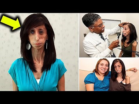 Remember the World’s Thinnest Woman Her Transformation Will Leave You Speechless!