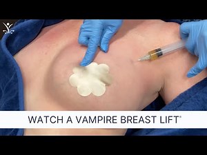 Non-Surgical Breast Lift for Better Cleavage and Natural Lift