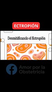 ✅ Para comprender el Ectropión cervical. #amorporlaobstetricia #ectropion #cervix | Amor por la Obstetricia