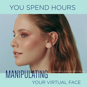 The chin anchors the face by bringing the rest of your features into proportion.1 Restylane Defyne is a dynamic filler approved to help smooth smile and laugh lines and enhance chin projection to achieve a more balanced aesthetic.2,3 Chin projection and shape are critical to facial attractiveness.1,4,5 The most commonly observed side effects are swelling, redness, pain, bruising, tenderness, lump formation, and itching at the injection site. To learn more about serious but rare side effects and 