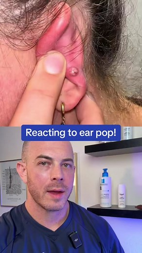 Dealing with Piercing Infections