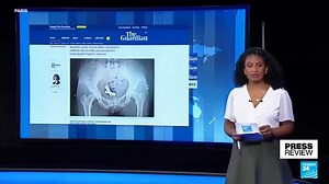 The brutal reality of conflict‑related sexual violence inflicted on Tigrayan women during the war. | ሄቨን ብርሃኑ ማንጁስ