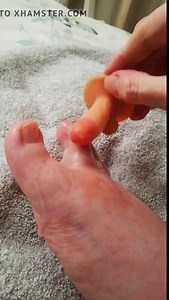 Deformed foot get fucked dildo footjob handicap disability