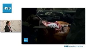 Management of the Obese Total Joint Patient Surgical Video