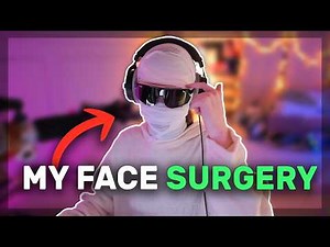 Talking about my Facial Feminization Surgery
