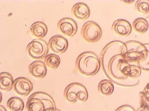 Parasitic Worm Trichinella Spiralis Sample Raw Stock Footage Video (100% Royalty-free) 5993105 | Shutterstock