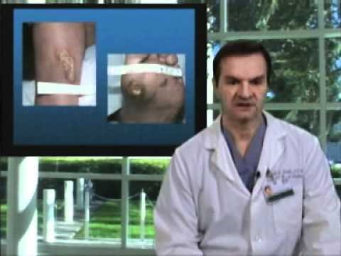 Principles for the Management of Chronic Wounds • Video • MEDtube.net