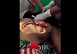 Autopsy video 2021 - Autopsy of a woman through a detailed angle - herdeaths