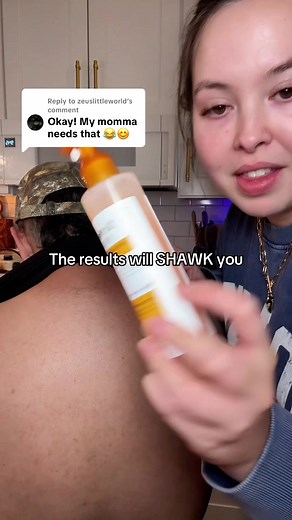 Dr. Melaxin Peel Shot for Back Blackheads