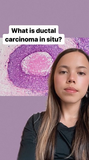 2.2K views · 15 reactions | Earlier today, ESPN Anchor Hannah Storm (@espnhannahstorm) revealed that she was diagnosed with ductal carcinoma in situ, or DCIS. DCIS is the earliest stage of breast cancer, which is why it’s sometimes referred to as stage 0 breast cancer. Learn more about DCIS at the link in bio. https://bit.ly/3lyvnpr | The Breast Cancer Research Foundation | Facebook