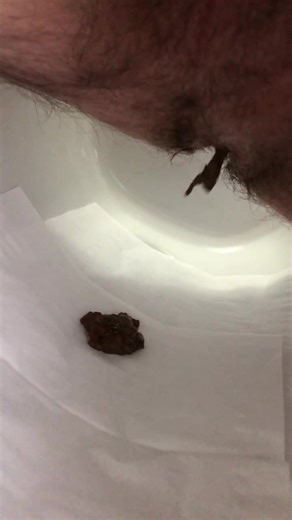 Diarrhea explosion! - video 2