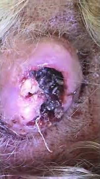 maggots in scalp