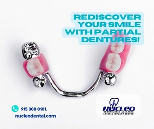 Partial dentures are a comfortable, affordable way to restore your smile and improve your bite. They blend seamlessly with your natural teeth, giving you the confidence to smile, speak, and eat with ease. 😁 #PartialDentures #SmileRestoration #ConfidenceBoost #OralHealth #NaturalLook . 📱🦷 915 308 0101 nucleodental.com . #NucleoDental #dentalclinicnearme #dentaltourismmexico #dentalimplantsjuarez #bestdentalserviceintown #dentalservice #elpasotexas #CiudadJuárez | Nucleo Dental