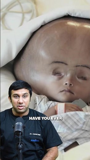 What is Hydrocephalus?