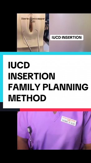 IUCD Insertion: Reliable Family Planning Method