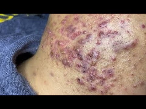 Relax Every Day SacDepSpa (Tuan P3-3) #995