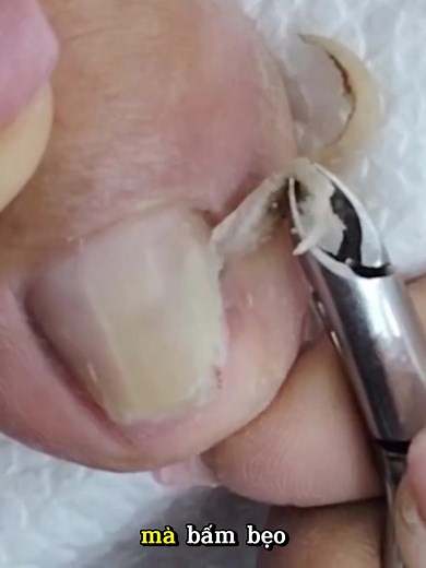 Hướng dẫn bấm khóe móng đẹp và an toàn